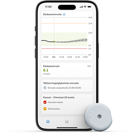 Kuvassa on SmartGuide- sensori, Accu-Check CGM -järjestelmä ja SmartGuide -sovelluksen näyttö.
