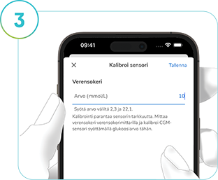 Kuvakaappaus SmartGuide-sovelluksen kalibrointinäytöstä, jossa näkyy, kuinka CGM-järjestelmä kalibroidaan.